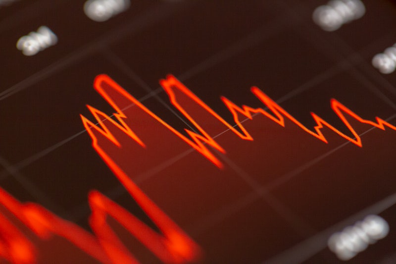 Hisse senedi piyasasında fiyat hareketlerini gösteren borsa grafiği